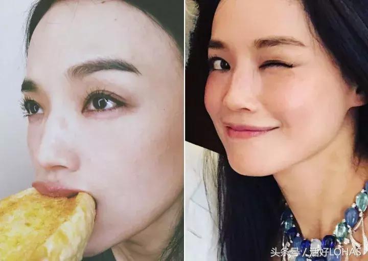 拯救发际线的生发神器,拯救发际线神器