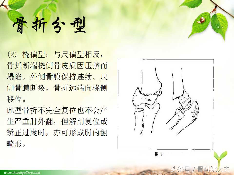 儿童肱骨干骨折处理方法,小孩胳膊肱骨骨折恢复最佳的方法