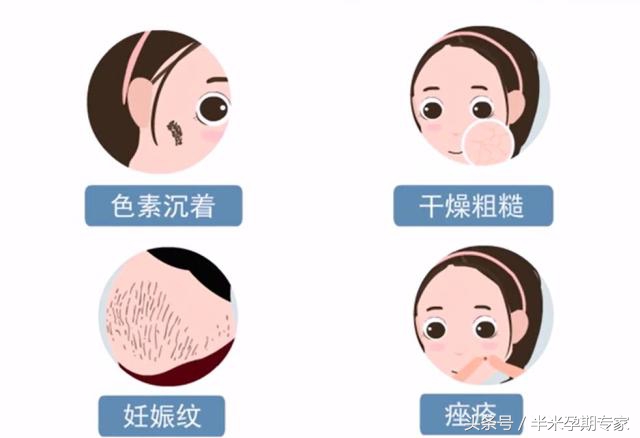 明星怎么保养皮肤,孕期怎样保养皮肤才不会长斑