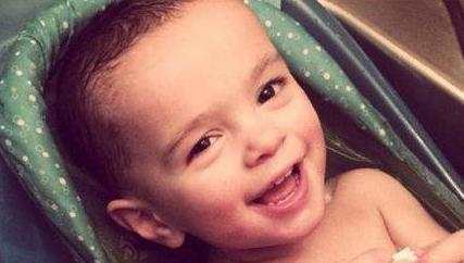 宝宝肤专家可以治疗湿疹吗,一岁半宝宝湿疹怎么治疗