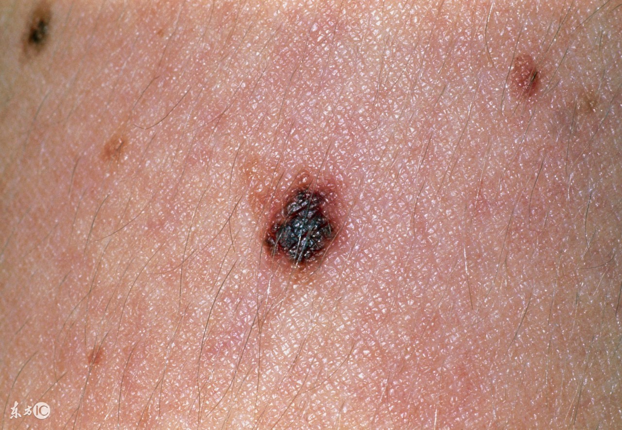 肝不好按摩哪里能补肝养肝,肝不好的有哪些表现