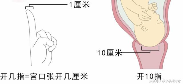 怎么理解胎儿入盆和开宫口