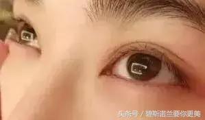 碧*诺斯**兰要你更美：用手抠掉痂皮，没色你怪谁？