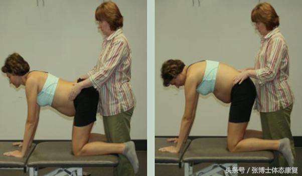 孕期耻骨痛怎么训练恢复,孕期耻骨疼怎么锻炼