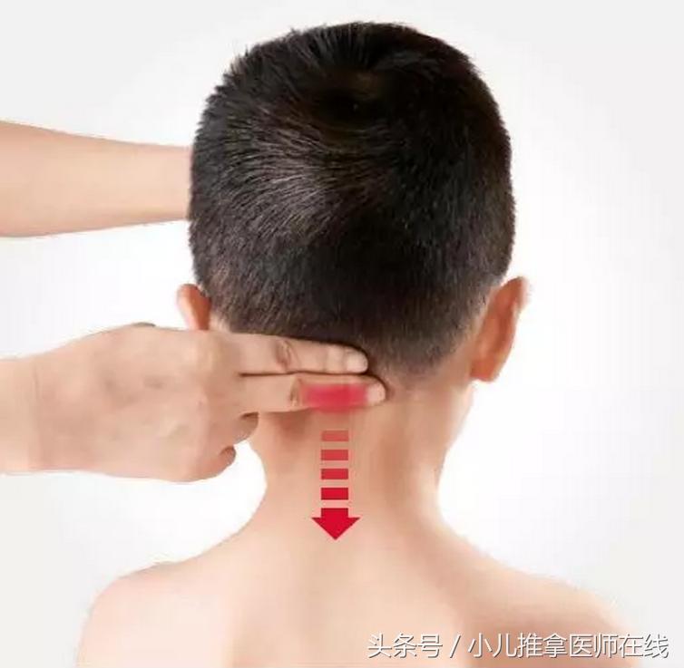 eb病毒发烧39度多怎么办,eb病毒反复发烧15天了