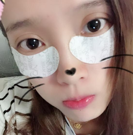 别把卧蚕当眼袋,卧蚕能去眼袋吗