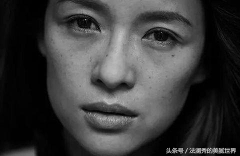 做激光祛斑后暴晒一天会反弹吗,激光祛斑会反弹吗有副作用吗