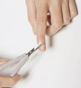 6个月婴儿手上长倒刺涂什么,宝宝手上起倒刺手指头起皮