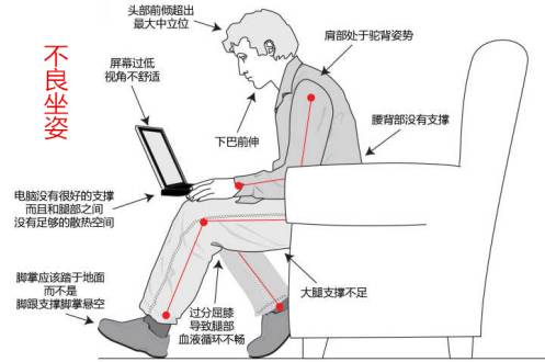 怎么判断是不是骨盆前倾矫正方法,矫正骨盆前倾的睡觉姿势
