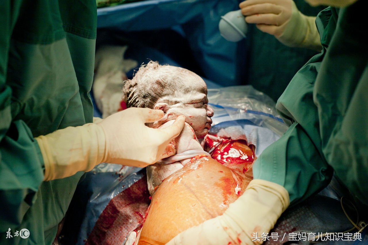 过了预产期宝宝没发动能否剖腹,产妇剖腹产24小时还没排气怎么办