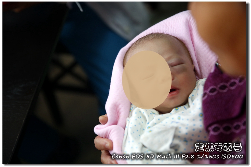 治疗头皮癣要多少钱,头皮上红斑为什么难治好