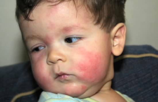 小小招牌益生菌测评,小小益生菌竟然有这么大功效