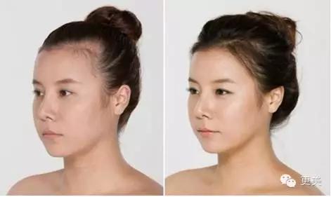 韩式半永久,韩式半永久都有什么