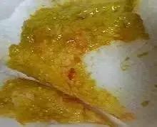 绿色便和黄色便的原因,黑绿色稀便是什么原因