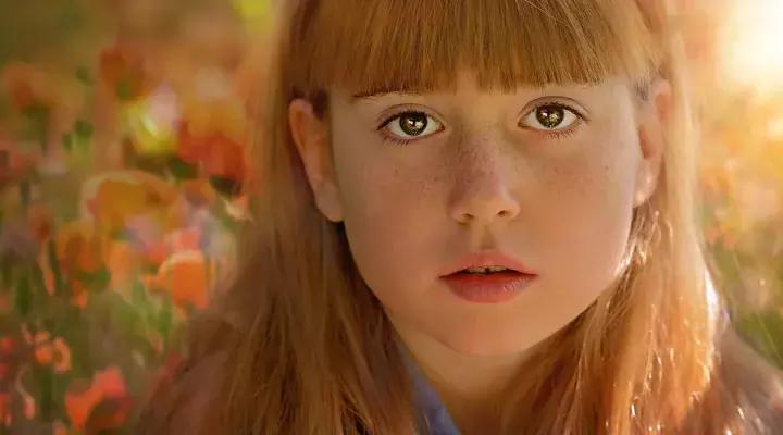 皮肤科医生教你去脸上长斑,皮肤医生讲斑的分类