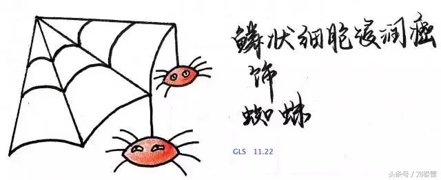 宫颈癌科普知识宣教视频,宫颈癌的科普知识宣传