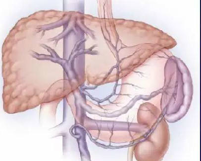 肝硬化晚期的4种并发症要警惕,肝硬化吐血发病前怎么预防