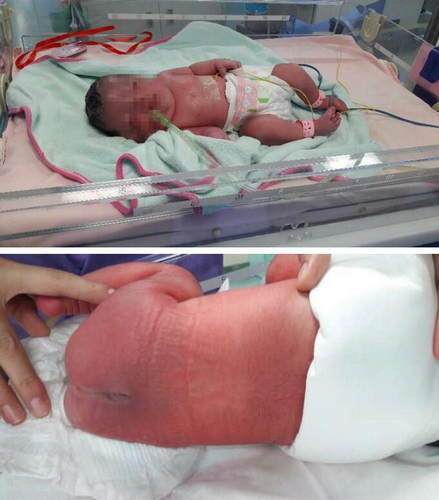 怀孕早期打保胎针对胎儿有影响吗,孕妇一针20000的保胎针