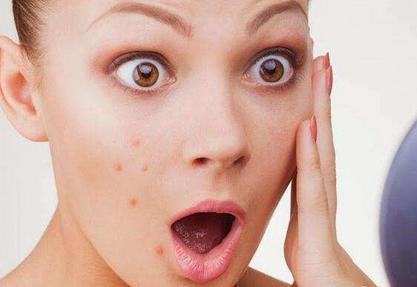 孕期长痘是雄激素高吗,孕期长痘可以涂什么