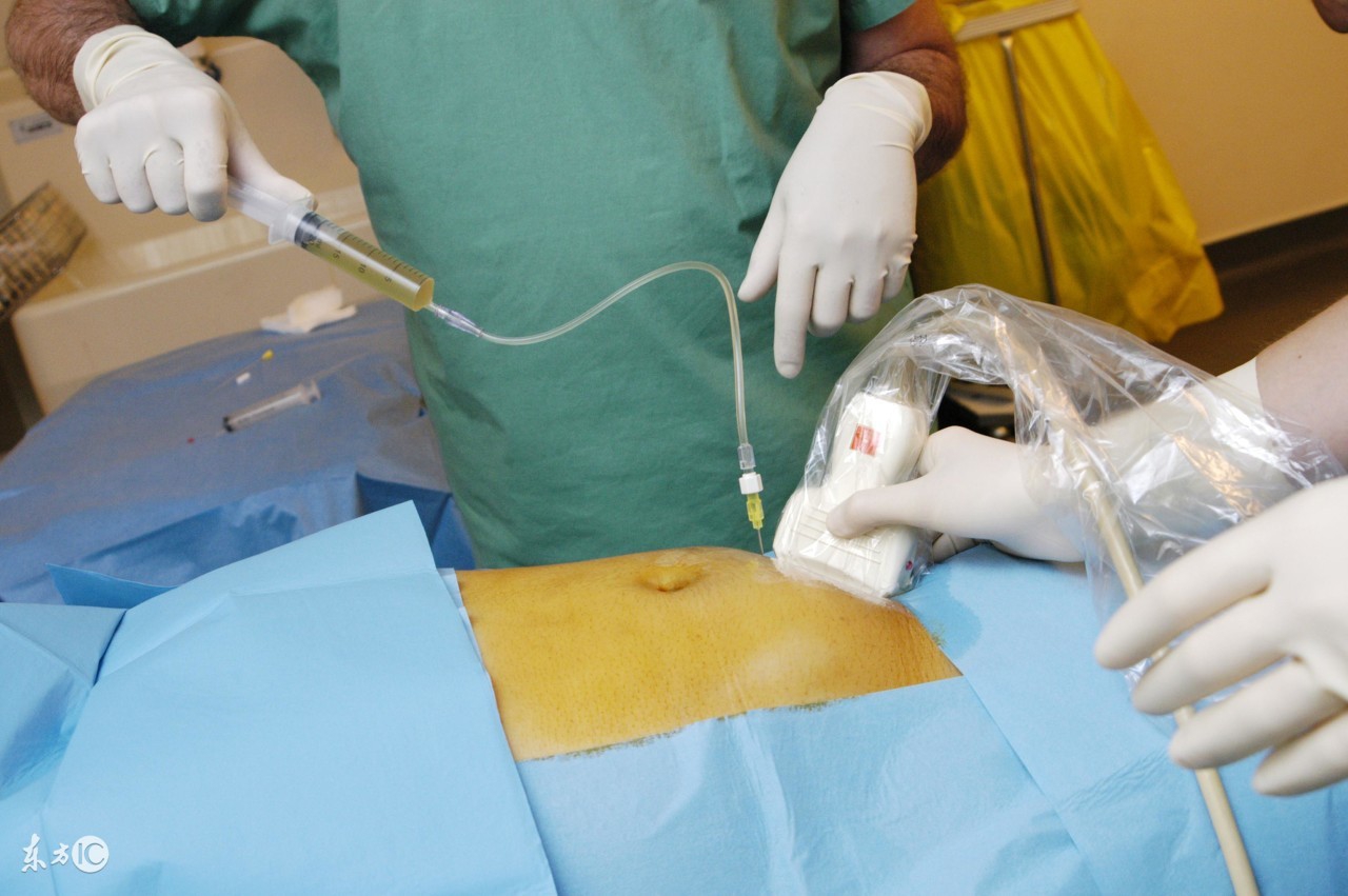 孕妇破水的原因及处理方法,孕妇破水注意事项有哪些