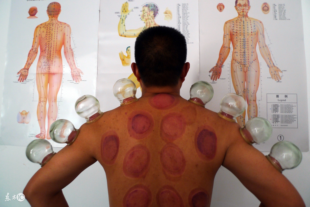 拔罐技巧视频教程全集,拔罐技巧怎么拔得更紧