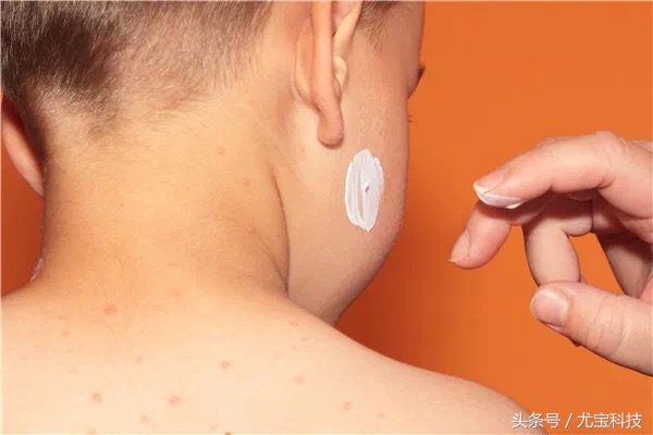 宝宝脸上有奶癣湿疹怎么好得快,宝宝脸上长奶癣用什么药膏好得快