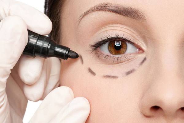 眼袋手术彻底去眼袋,去眼袋手术改善眼角纹吗