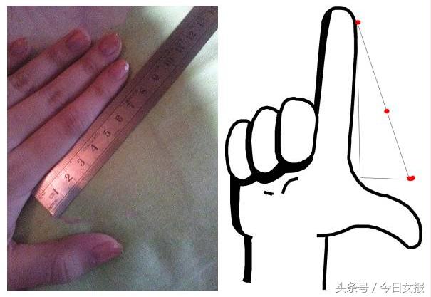 产妇42天盆底肌筛查,生完孩子去医院做盆底肌筛查