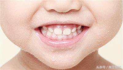 儿童乳牙20个会全部换恒牙吗,儿童换牙时恒牙刚冒需要拔乳牙吗