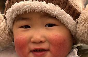 掌握这5个诀窍，冬天宝宝的小脸儿再也不皴啦！