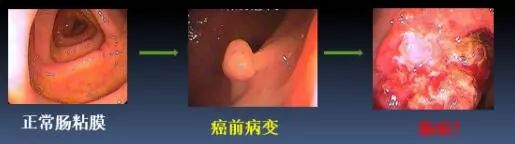 直面病魔,面对病魔勇敢生活