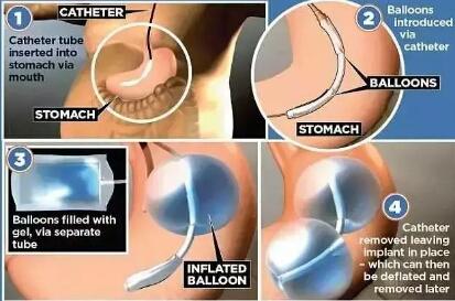 不吃药减肥方法分享,减肥黑科技不用动也可以狂瘦
