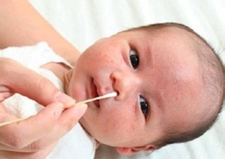 两岁宝宝鼻塞严重不通气小妙招,小儿鼻塞怎么办速效办法小妙招