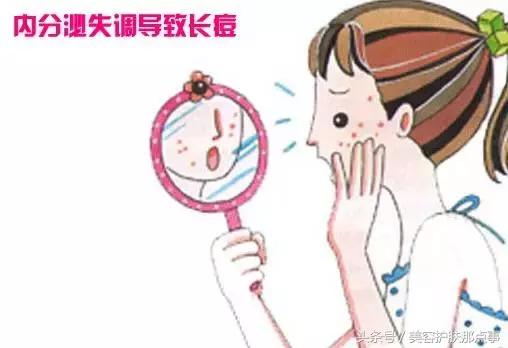 内分泌失调下巴长痘吃什么药调理,内分泌失调和下巴长痘的中药配方