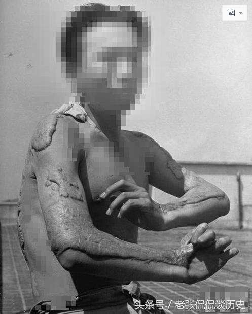 广岛核辐射照片,广岛核辐射是什么原因