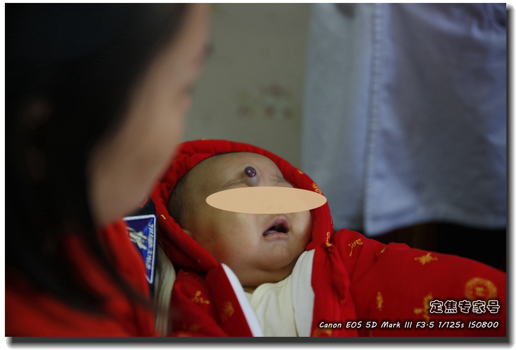 皮肤专家诊室故事连载之五,手心和眉心“开天眼”?