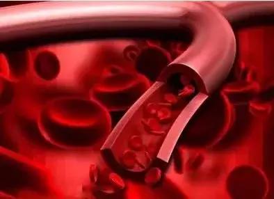 实话实说深海鱼油有没有用,深海鱼油真正功效