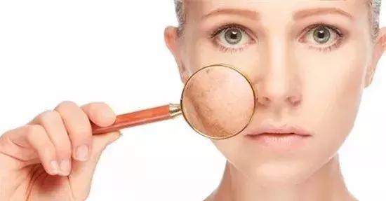 冬天皮肤起皮干燥有碎屑怎么保湿,秋冬干燥起皮补水保湿就选它