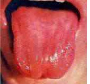 蒲辅周讲舌诊,蒲辅周怎么看舌诊