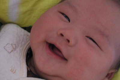 引起宝宝湿疹的原因和解决方案,宝宝容易长湿疹妈妈应该注意什么