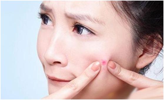 换季长痘是什么原因,换季长痘