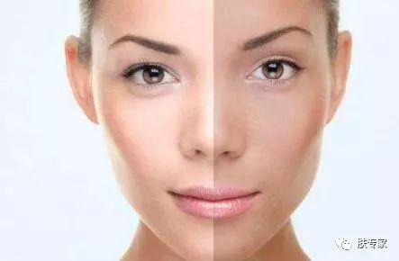 t字区护肤的正确方法,护肤品t字部位怎么护理