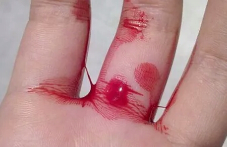 你听说过吗？备孕也有“黑色星期一”！