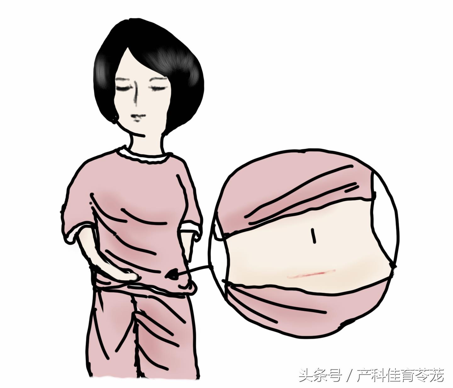 剖宫产术后切口回声改变,剖宫产术后切口改变有问题吗