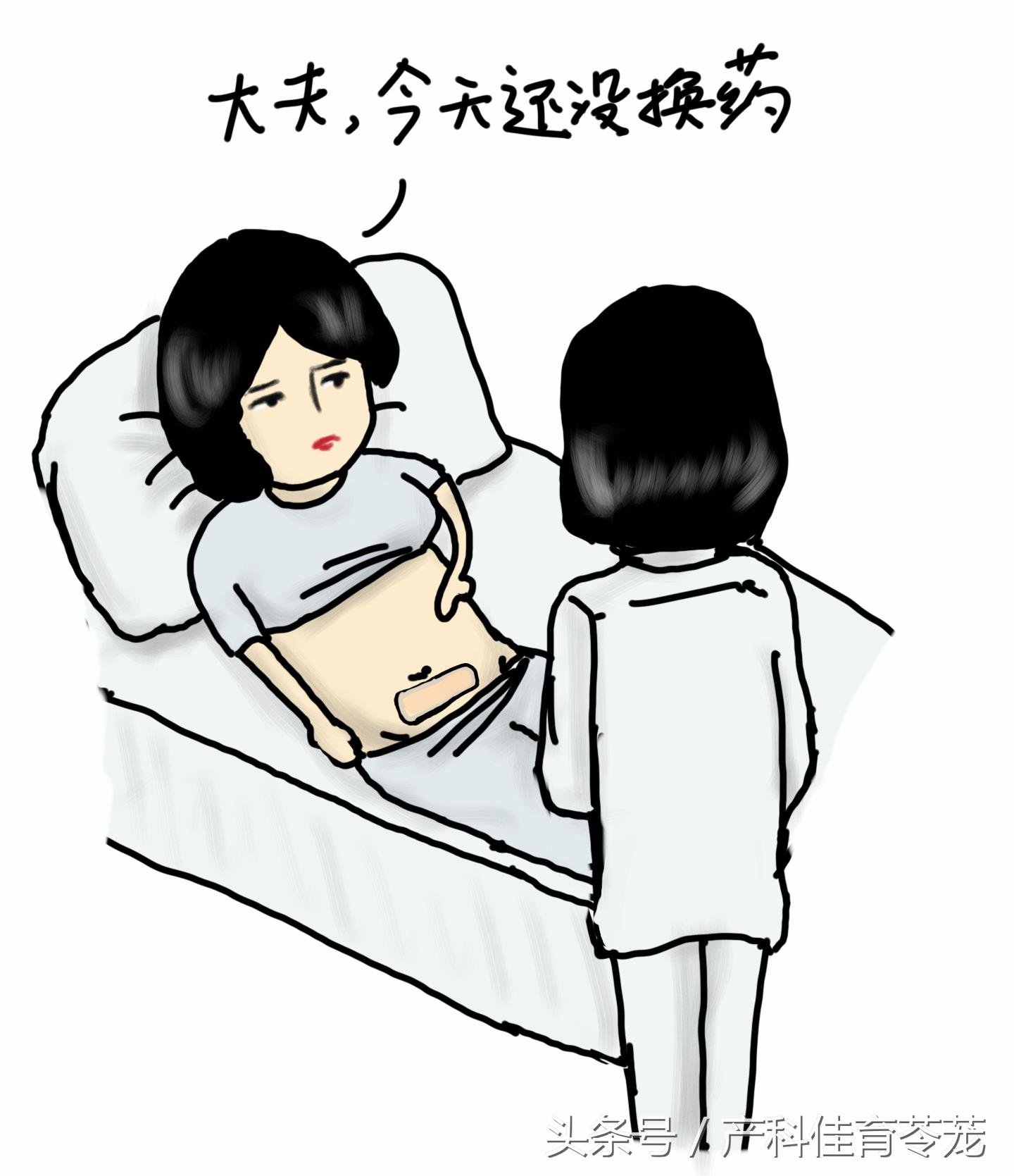 剖宫产那么大个口子，护理并不难