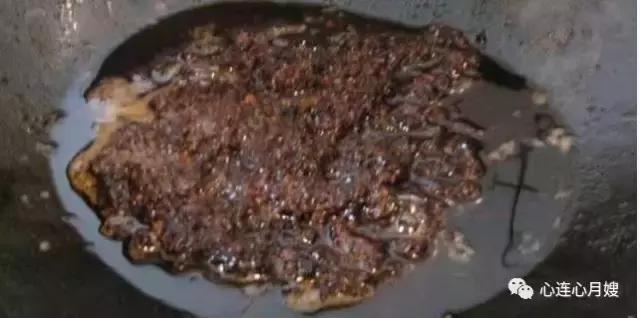 儿童便血吓坏了,小孩便血是小肠原因吗