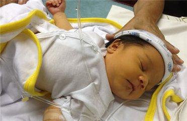 认识新生儿黄疸及其处理方法，新手父母不用慌！