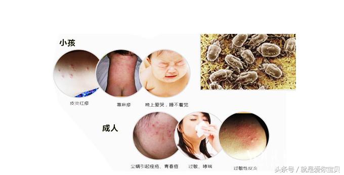 育儿锦囊睡眠,新生儿枕头的护理新知