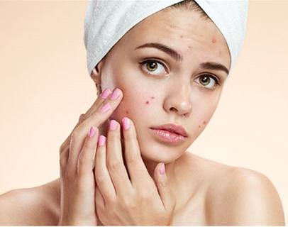 脸颊额头长痘是什么原因怎么解决,脸颊额头长痘的原因及调理方法