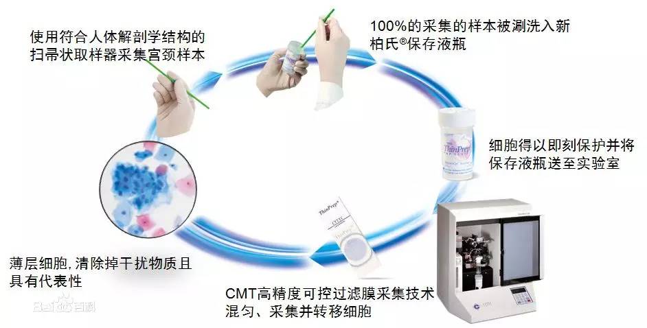 子宫颈癌及其三级防治措施